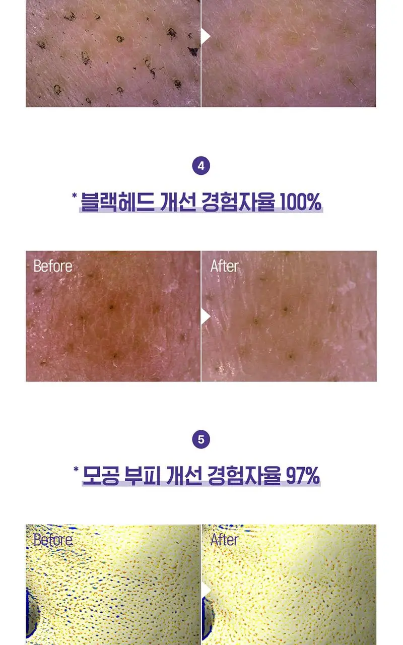[지성피부추천] 해피바스 마이크로 클린 딥 클렌징 폼 150G 상세페이지 9